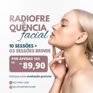 Radiofrequência